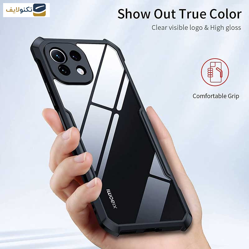 کاور گوشی اپیکوی  شیائومی Mi 11 Lite 4G-5G - 11 Lite 5G NE مدل Xundd Beatle - Epicoy Xundd Beatle Case For Xiaomi Mi 11 Lite 4G-5G - 11 Lite 5G NE